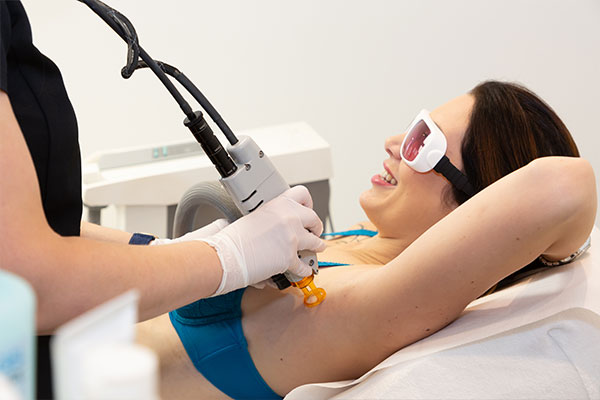 epilation laser