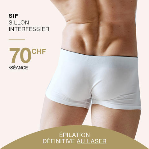 centre-epilation-laser-sif-homme-lausanne