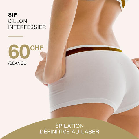 centre-epilation-laser-sif-lausanne