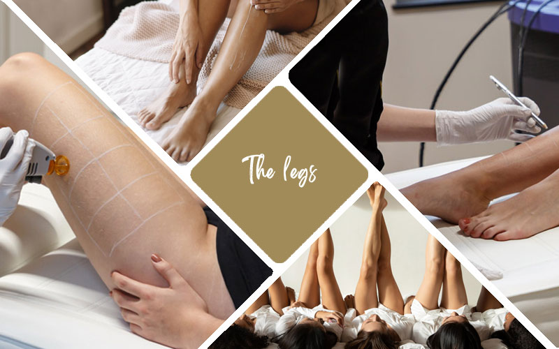 laser hair removal treatment legs