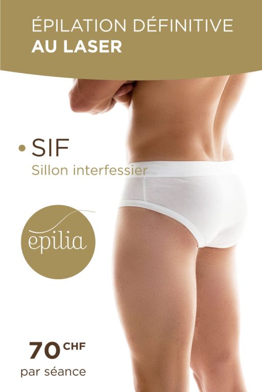 Épilation laser SIF homme
